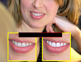 XVRImage Trends PearlyWhites 2.10ע԰